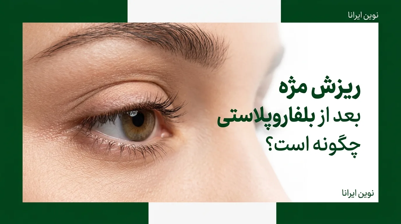 ریزش مژه بعد از بلفاروپلاستی چگونه است؟